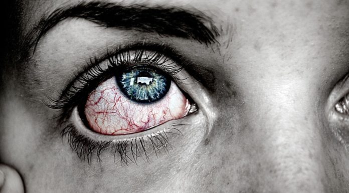 Jęczmień na oku: przyczyny, objawy i leczenie Jęczmień na oku