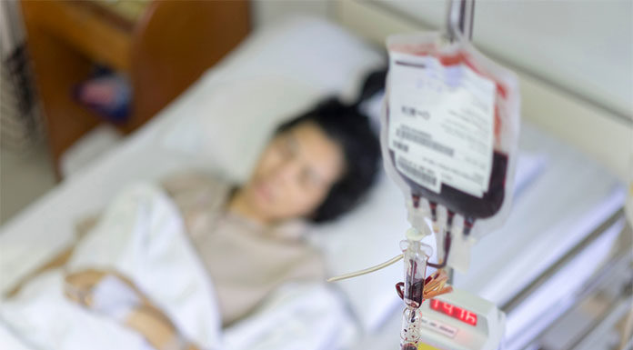 Na czym polega pobranie szpiku – dowiedz się więcej